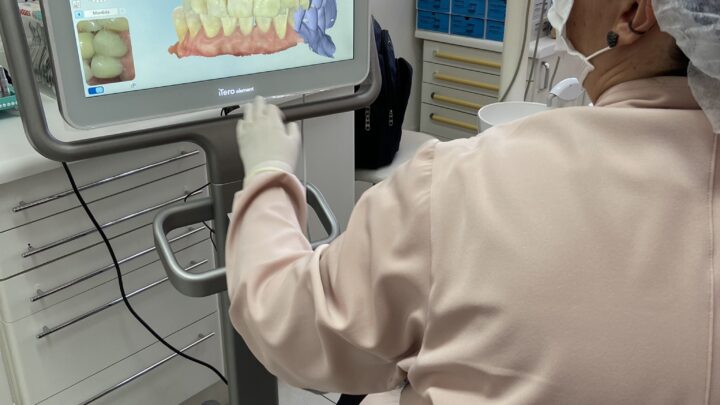 Aparelho invisível: tecnologia é aliada na correção dos dentes