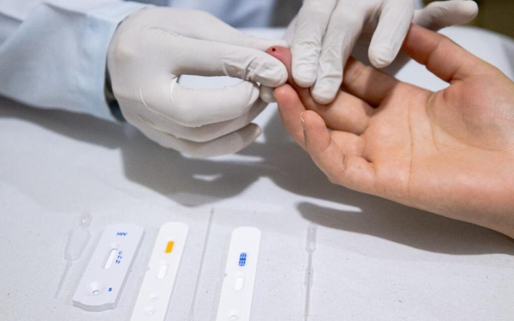 Hepatites B e C causaram 83 mil mortes em 2 décadas no País