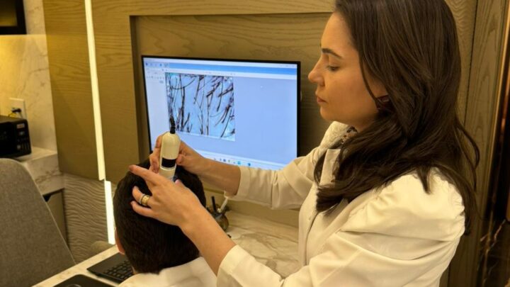 Genética é motivo da queda de cabelo em 80% dos pacientes