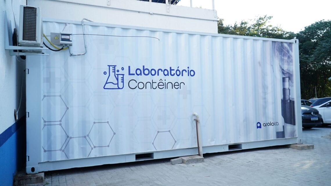 Laboratórios compactos para diagnóstico chegam às UPAs de SP