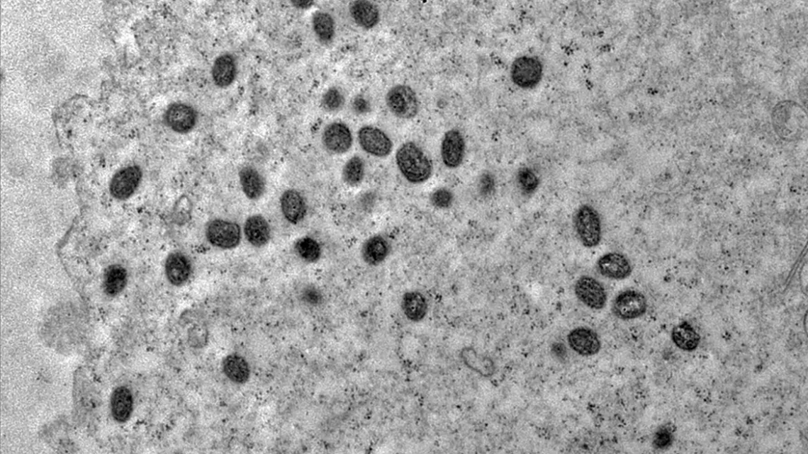 Brasil em atenção contra Mpox: 2024 já supera 2023 no número de casos