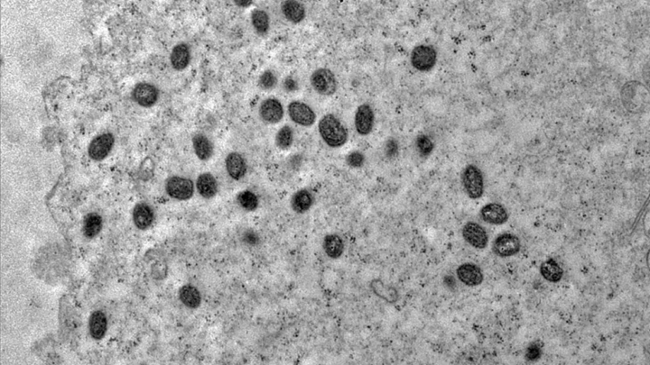 Brasil em atenção contra Mpox: 2024 já supera 2023 no número de casos