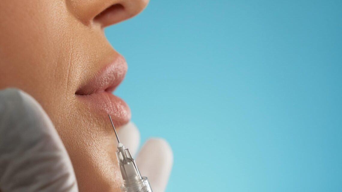 Técnica Safe Lips reduz riscos no preenchimento labial