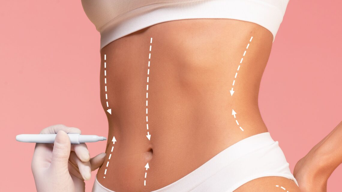 Naturalidade é a nova tendência na cirurgia plástica