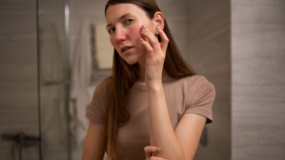 ANS avalia inclusão de tratamento para pacientes com lúpus