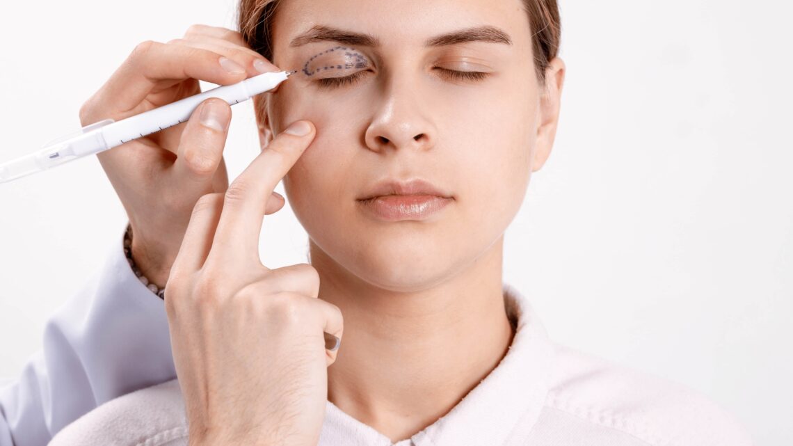 Cirurgia de pálpebras lidera ranking de plásticas no mundo