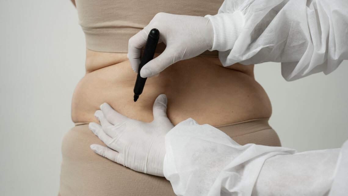 Cirurgias estéticas ultrapassam 17,4 milhões em 2024