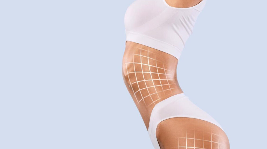 Lipo com tecnologias indica avanço na cirurgia plástica