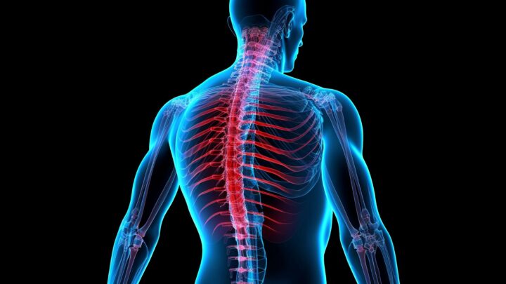 Técnicas minimamente invasivas tratam dores na coluna