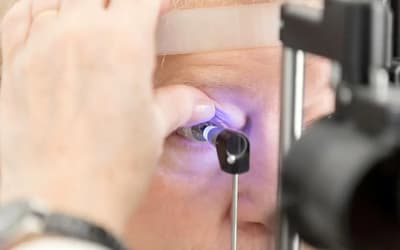 Transplante de córnea: 33 mil pessoas aguardam cirurgia no Brasil