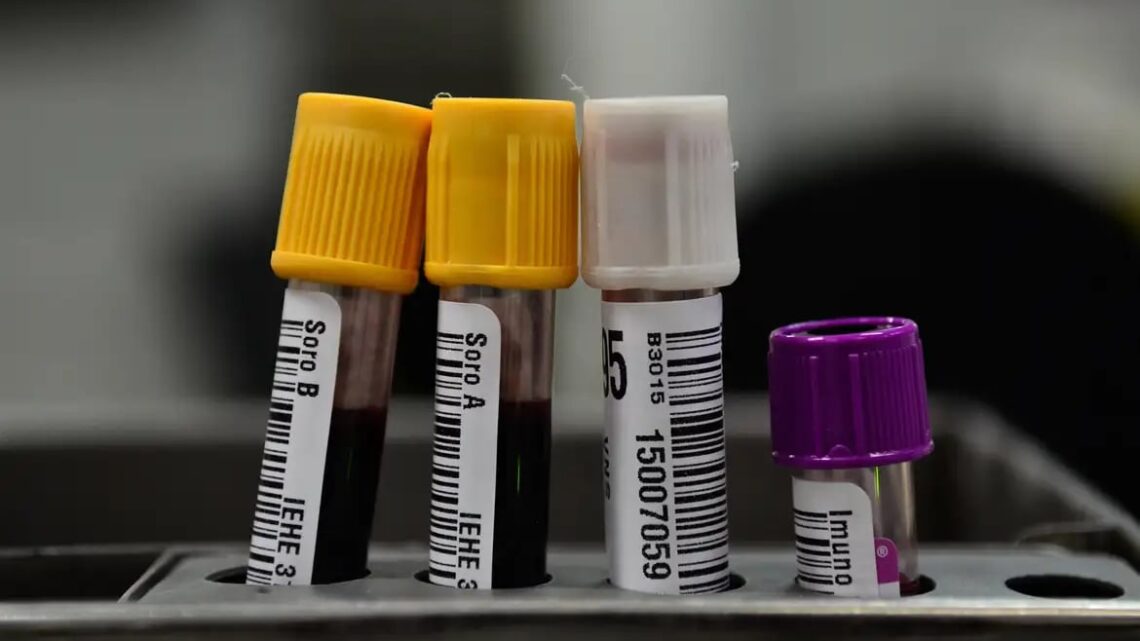 TIRA-DÚVIDAS: saiba mais sobre hepatites B e C