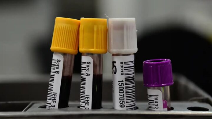 TIRA-DÚVIDAS: saiba mais sobre hepatites B e C