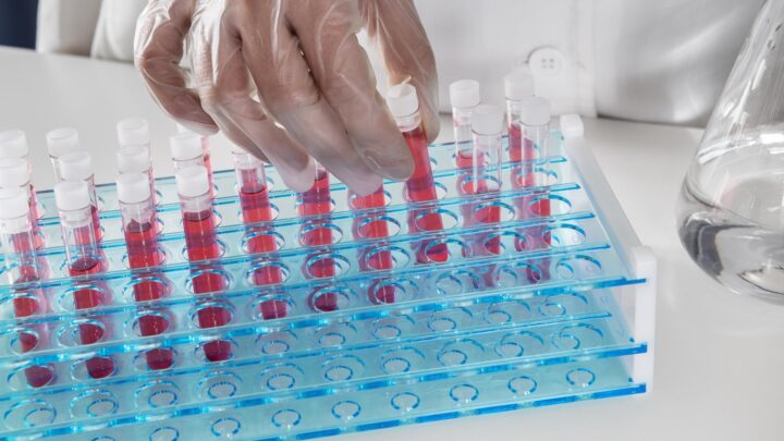 Escovas técnicas mantêm higienização eficiente de vidrarias em laboratórios