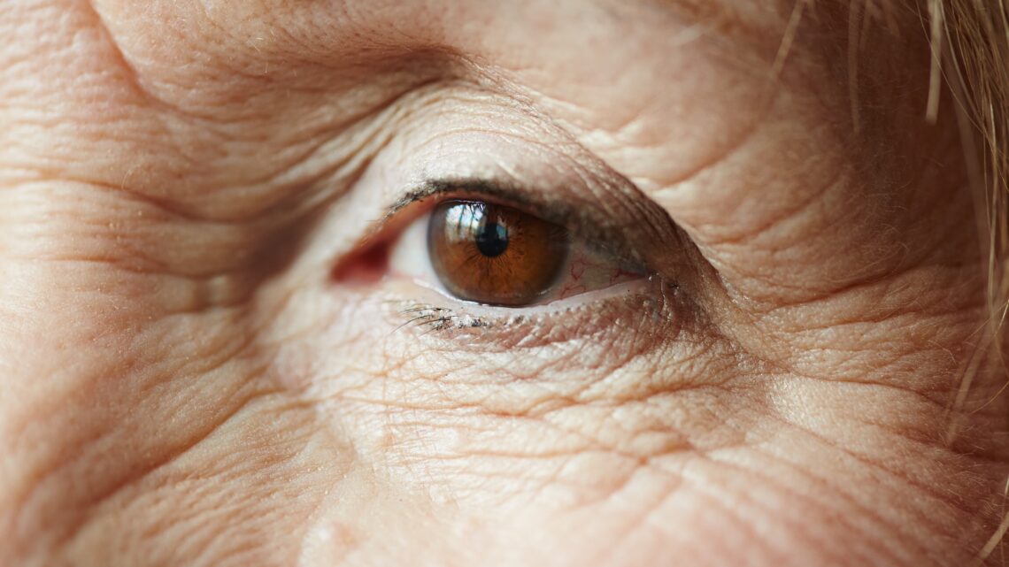 Lasers e cirurgias ampliam opções contra o glaucoma