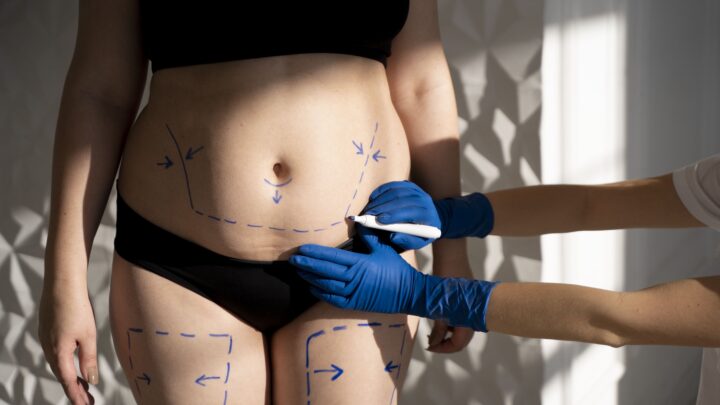 Exposição solar exige cuidados específicos antes e após cirurgias plásticas