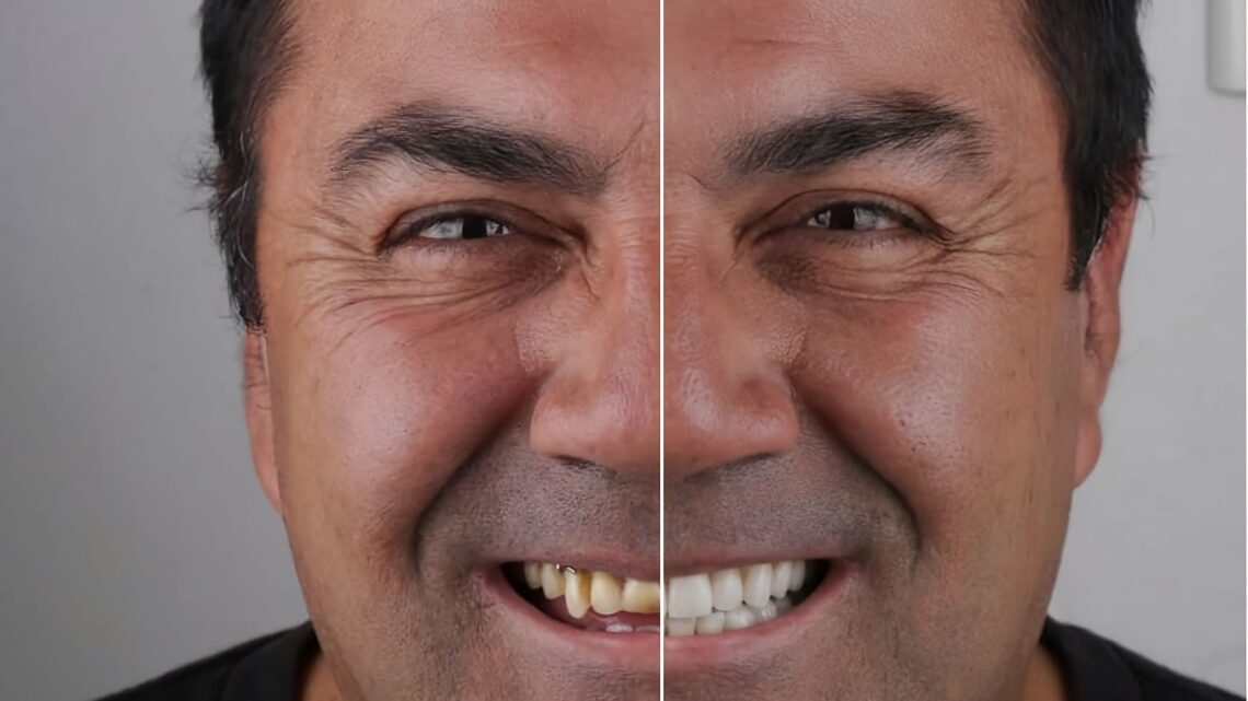 Tecnologia ajuda dentistas a prever resultados estéticos