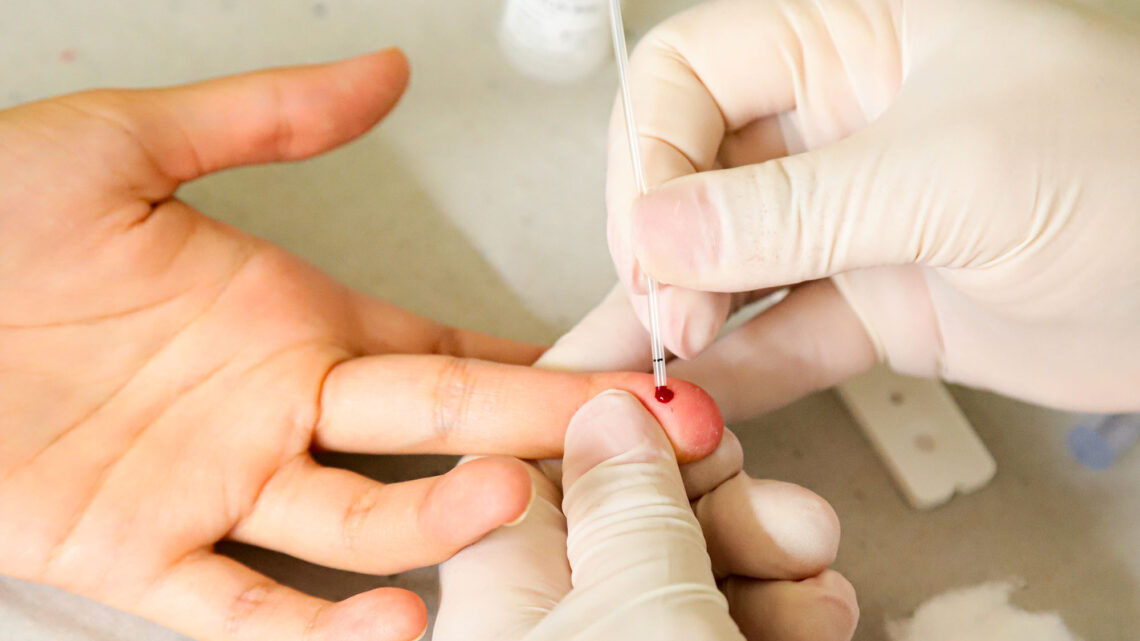 Saúde de Santa Bárbara orienta sobre cuidados com a saúde sexual durante o Carnaval