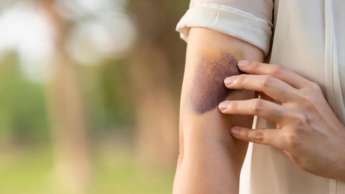 Fevereiro Laranja amplia debate sobre leucemia e doação de medula óssea no Brasil