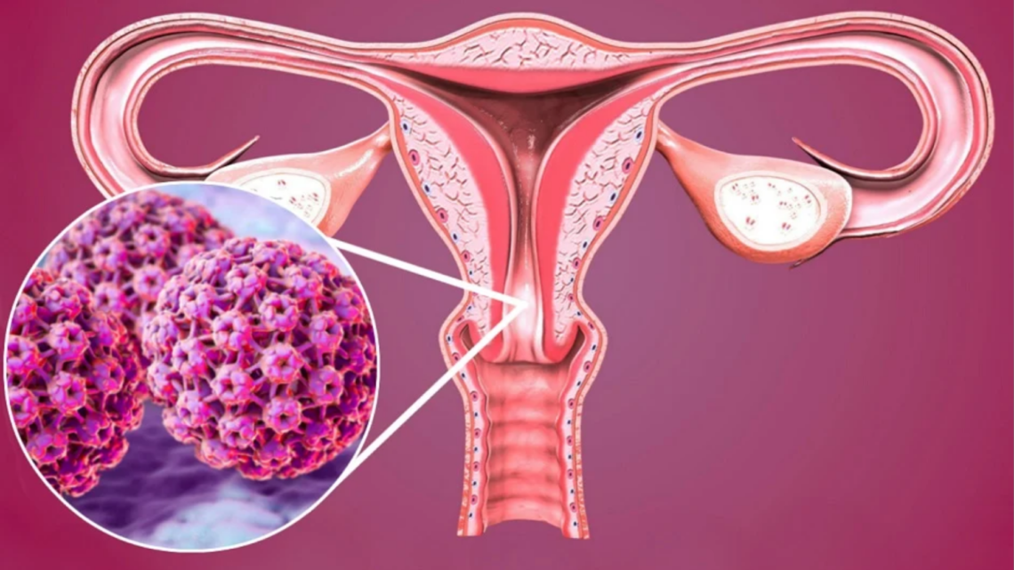 São Paulo já registra 87 novos diagnósticos em 2026; em 2025, foram 2.196 casos ao todo