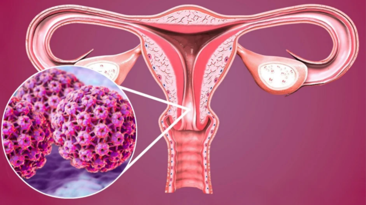 São Paulo já registra 87 novos diagnósticos em 2026; em 2025, foram 2.196 casos ao todo