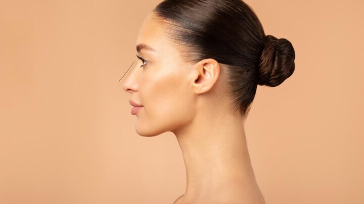 Avanços na rinoplastia aprimoram estética e função nasal