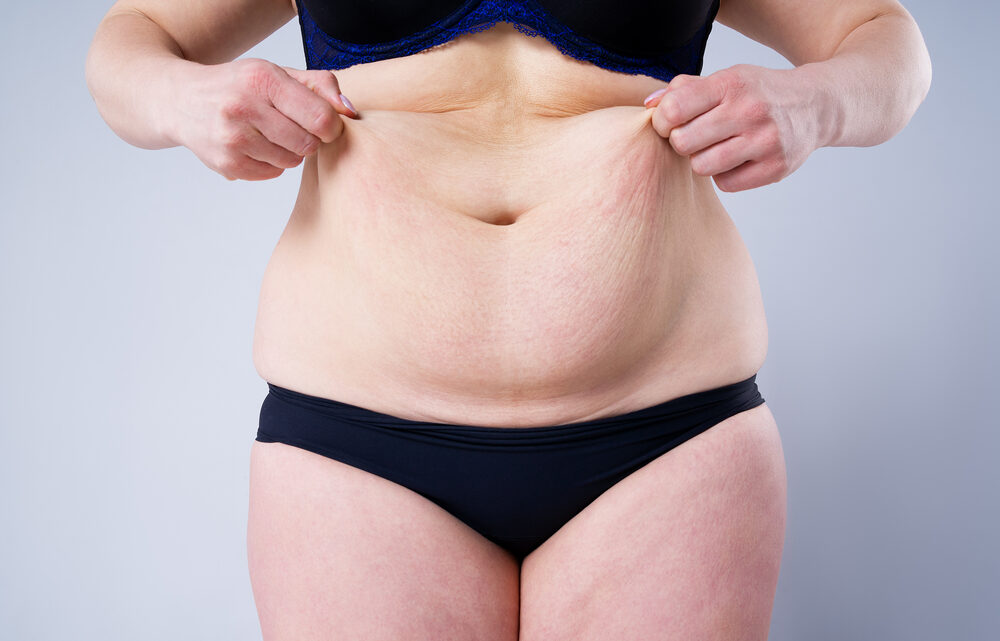 Cirurgias plásticas aumentam devido a canetas emagrecedoras