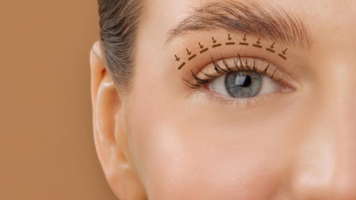 Blefaroplastia envolve função ocular além da estética