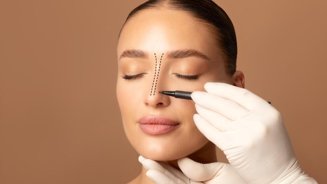 Rinoplastia associa correção estética e função respiratória