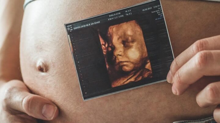 Ultrassonografia obstétrica avança no diagnóstico pré-natal