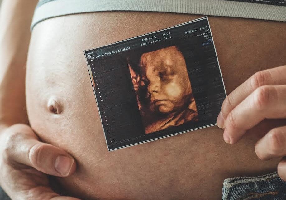 Ultrassonografia obstétrica avança no diagnóstico pré-natal