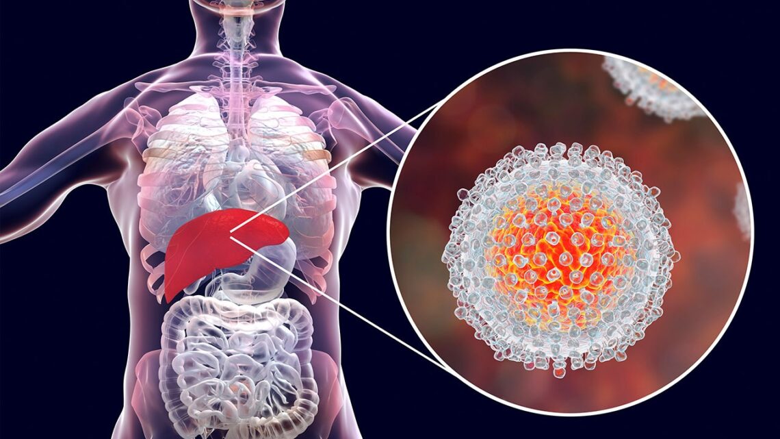 Julho Amarelo: Brasil registrou mais de 826 mil casos de hepatites virais; infectologista esclarece mitos e verdades sobre as doenças