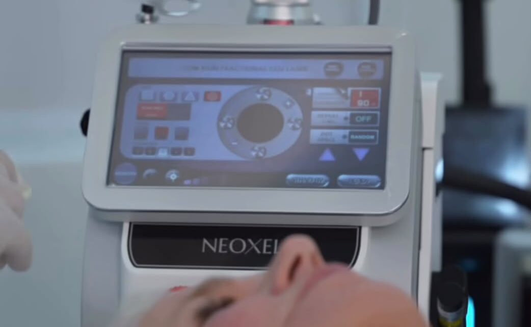 Laser de CO2 Neoxel ganha destaque com Xuxa