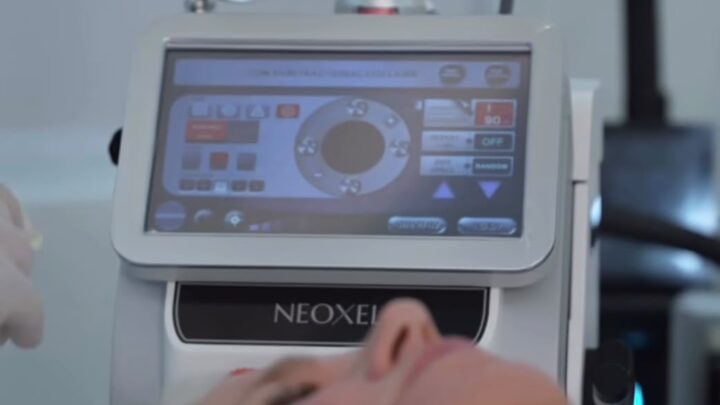 Laser de CO2 Neoxel ganha destaque com Xuxa